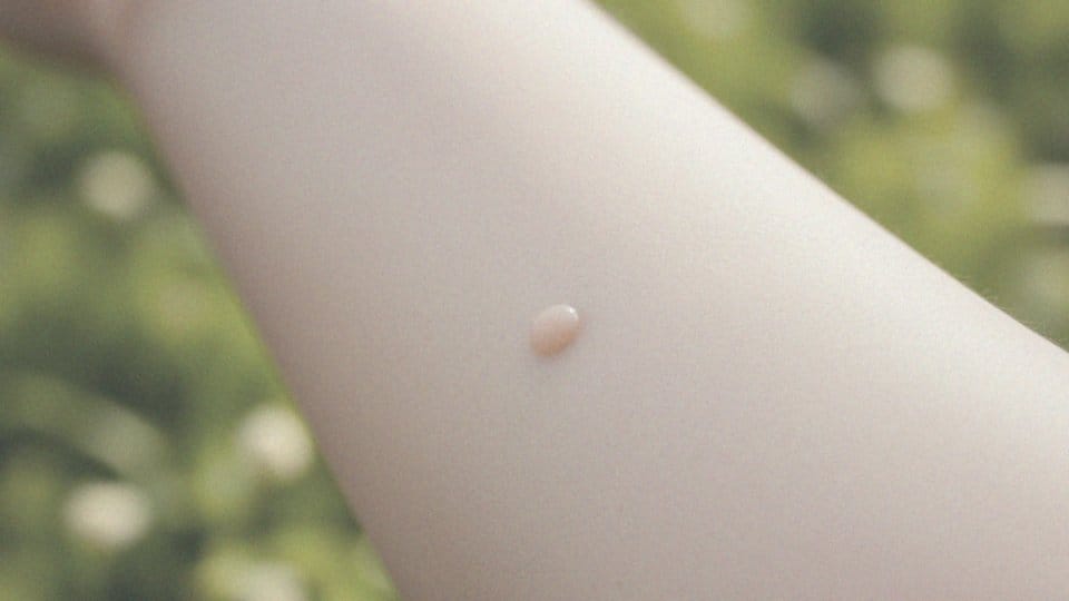 Kiedy pieprzyki znikają? Przyczyny i obserwacja zmian skórnych